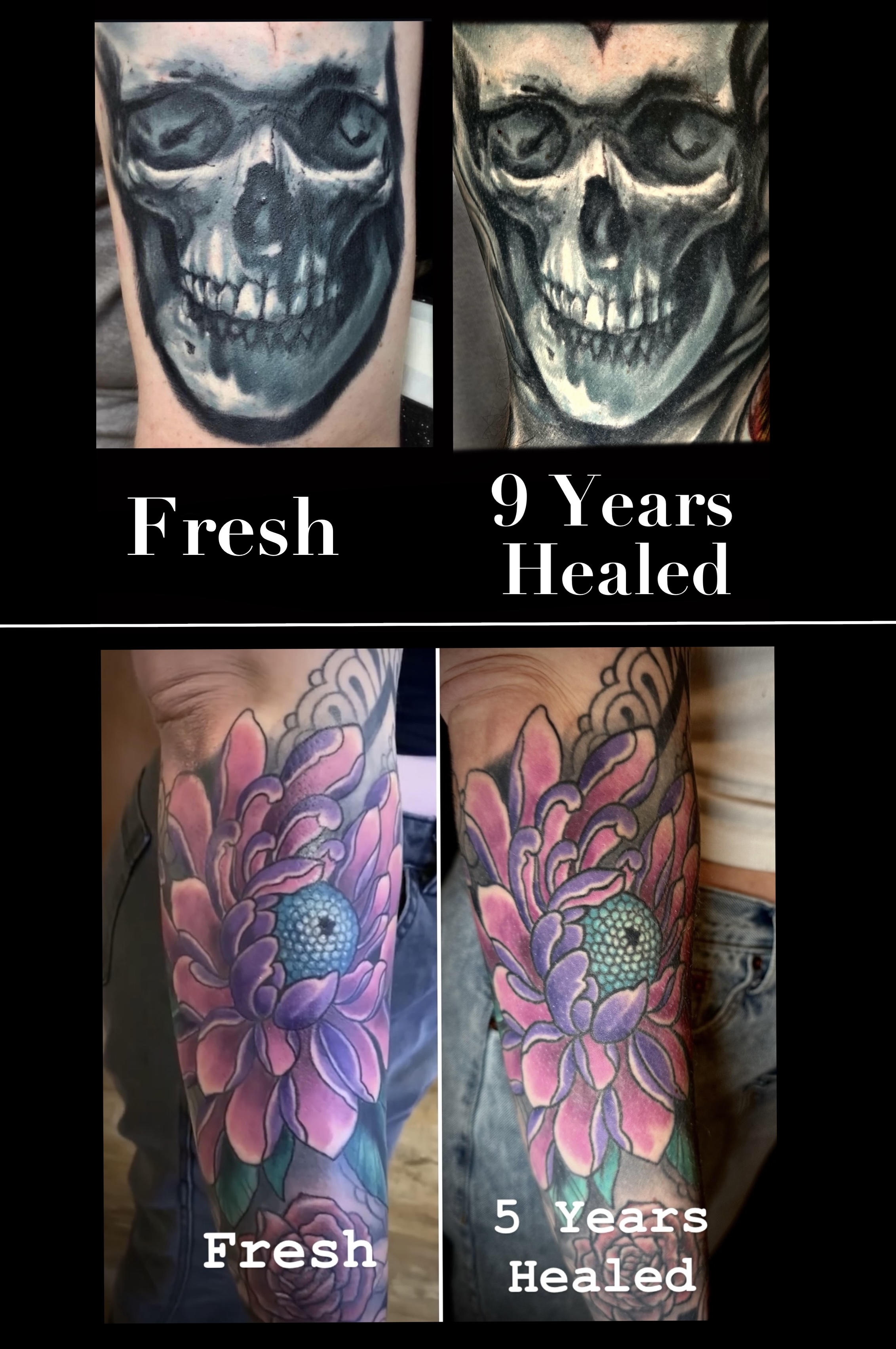 Why Do I Care About Healed Pics?