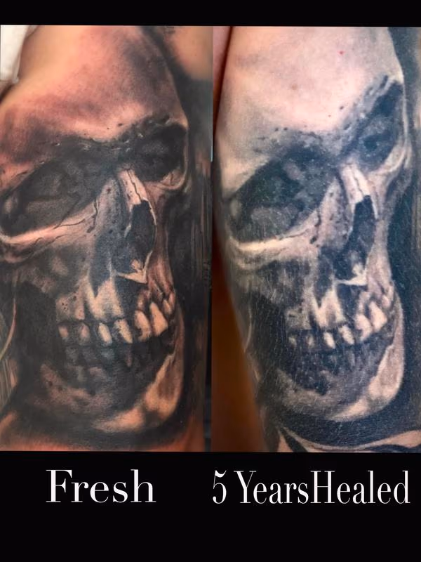 Skull