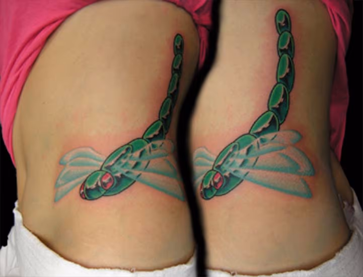 Dragonfly