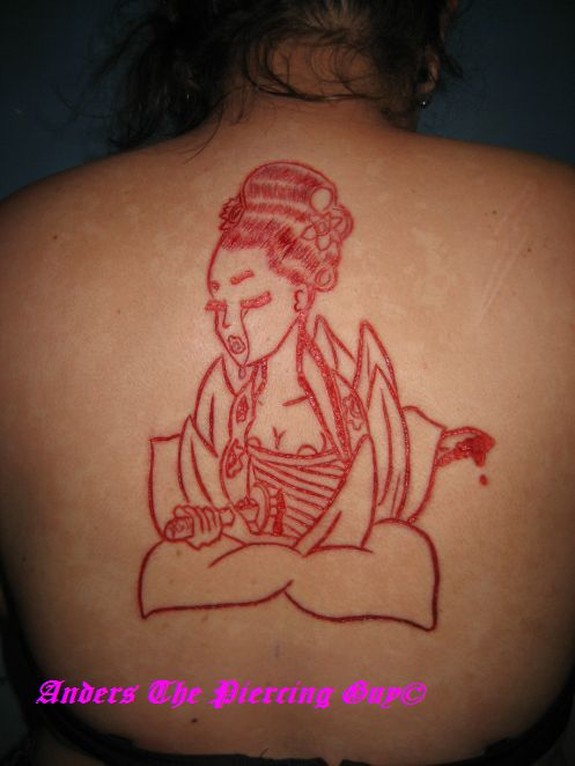 Scarification & skin peel combo