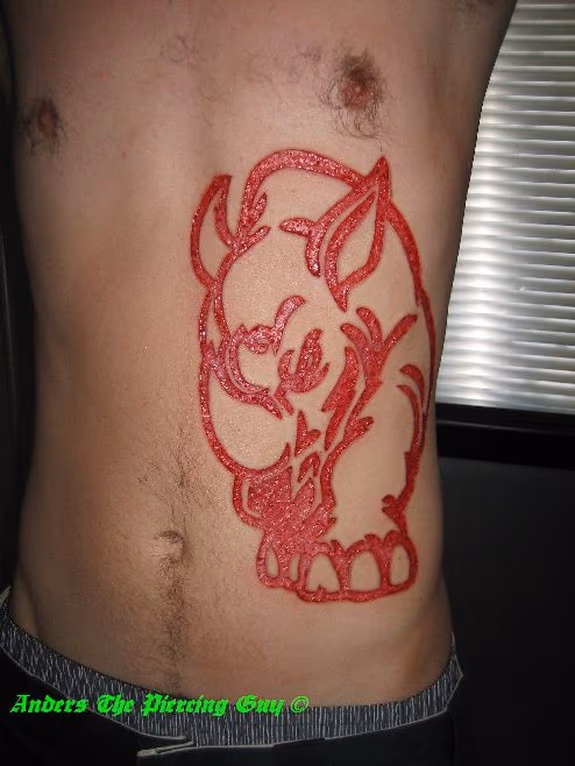 Skin Removal