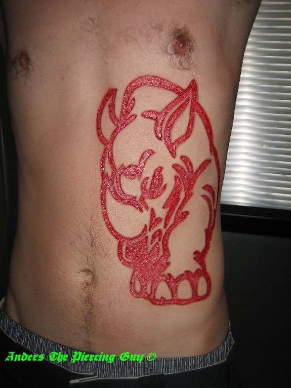 Skin Removal