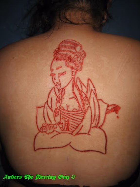 Scarification & skin peel combo