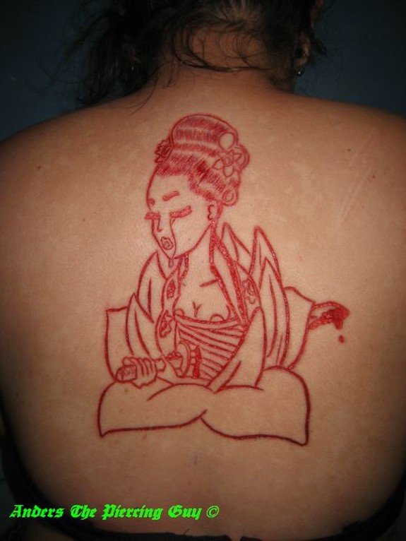 Scarification & skin peel combo