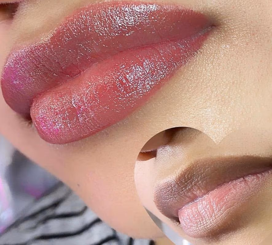 Lips