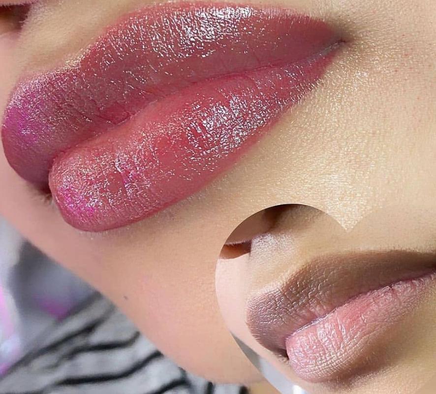 Lips
