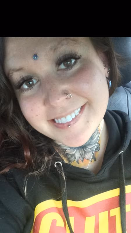 Dermal