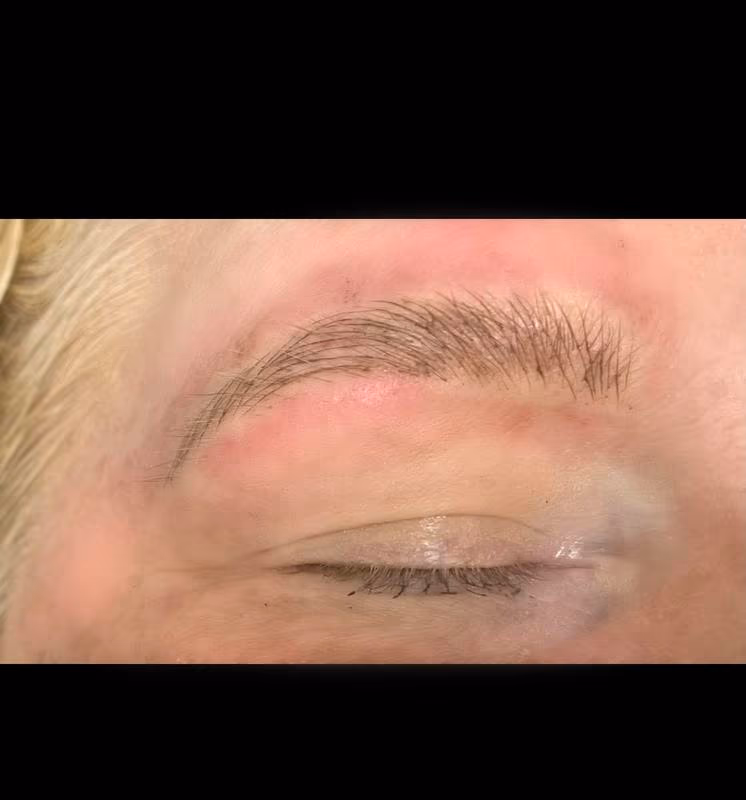 Brow2