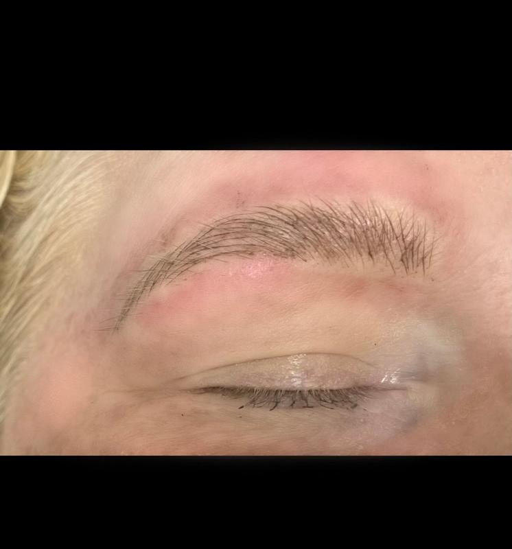 Brow2