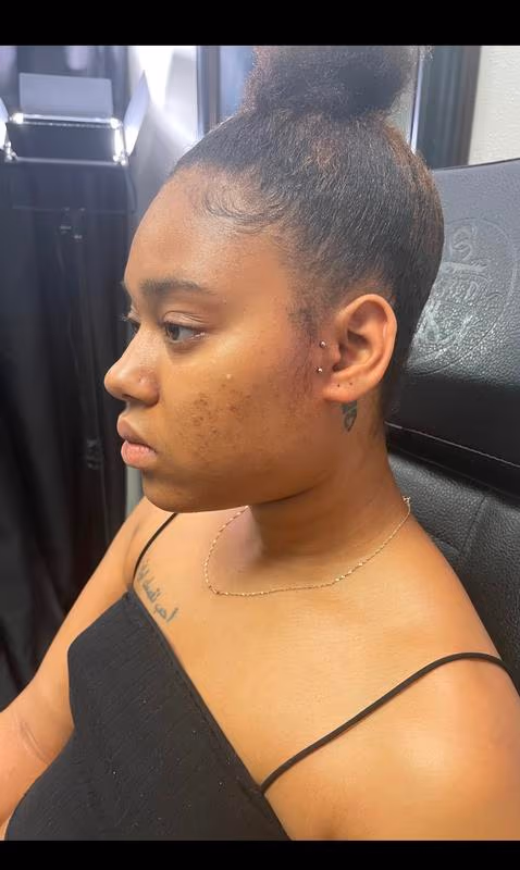 Anti tragus