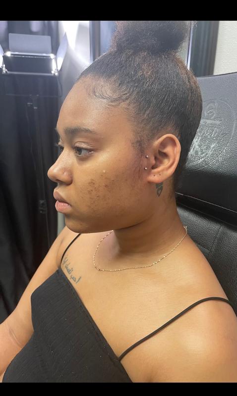 Anti tragus