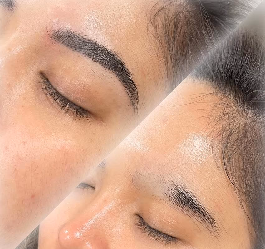 Brows