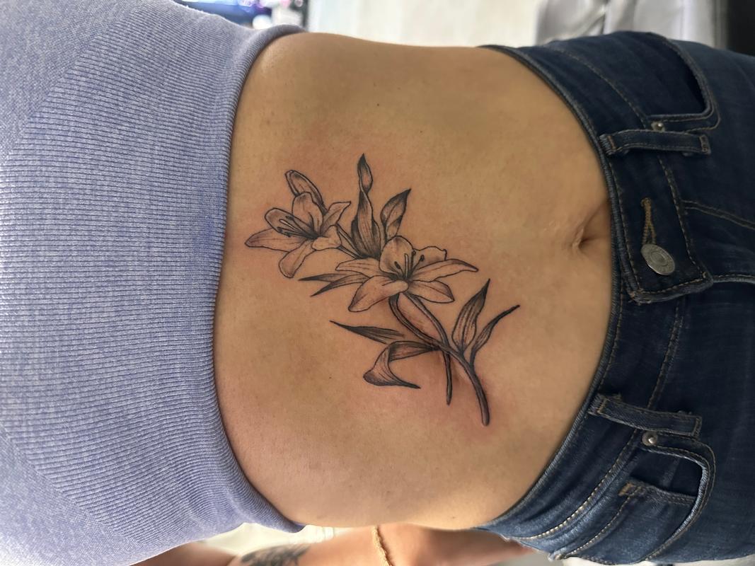 Scar coverup