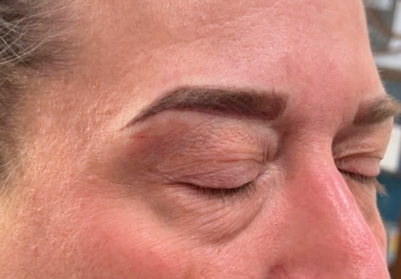 Brow5
