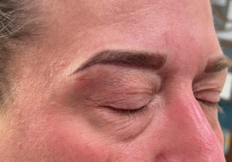 Brow5