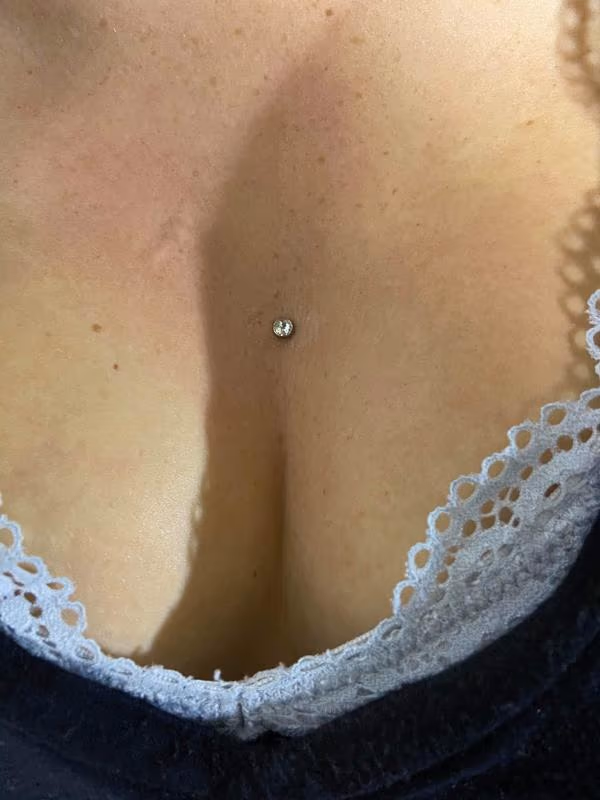 Sternum dermal