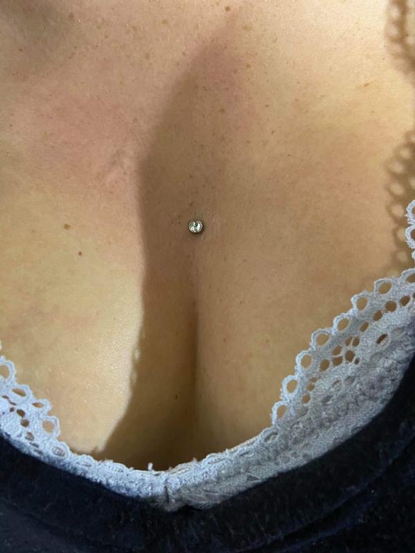 Sternum dermal