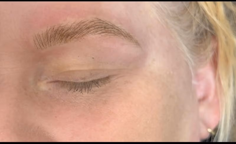 Brow3