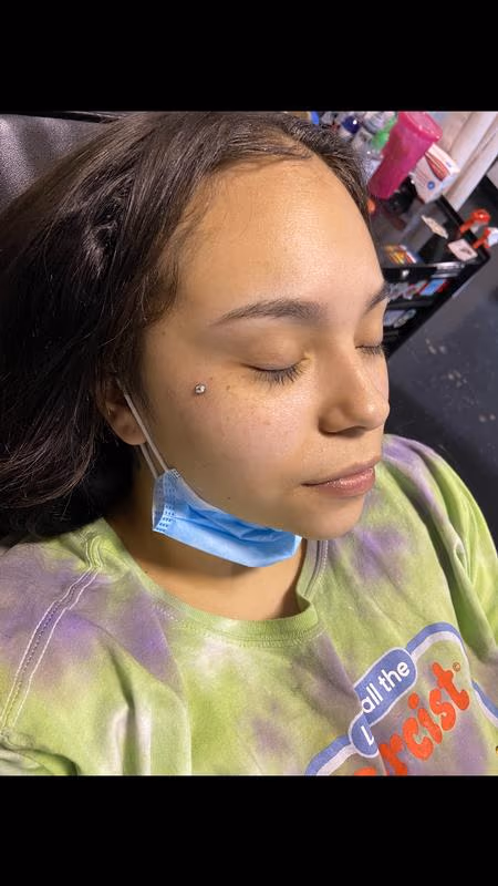 Dermal