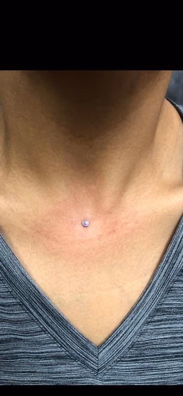 Dermal