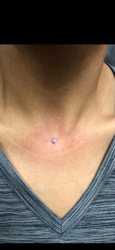 Dermal