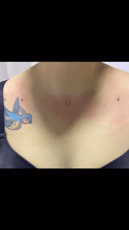 Dermal