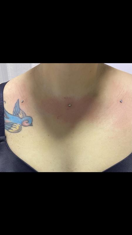 Dermal