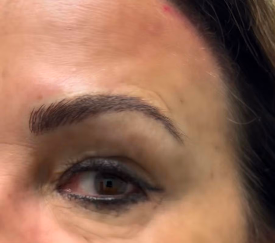 Brow1