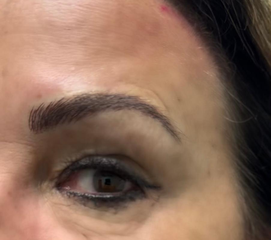 Brow1