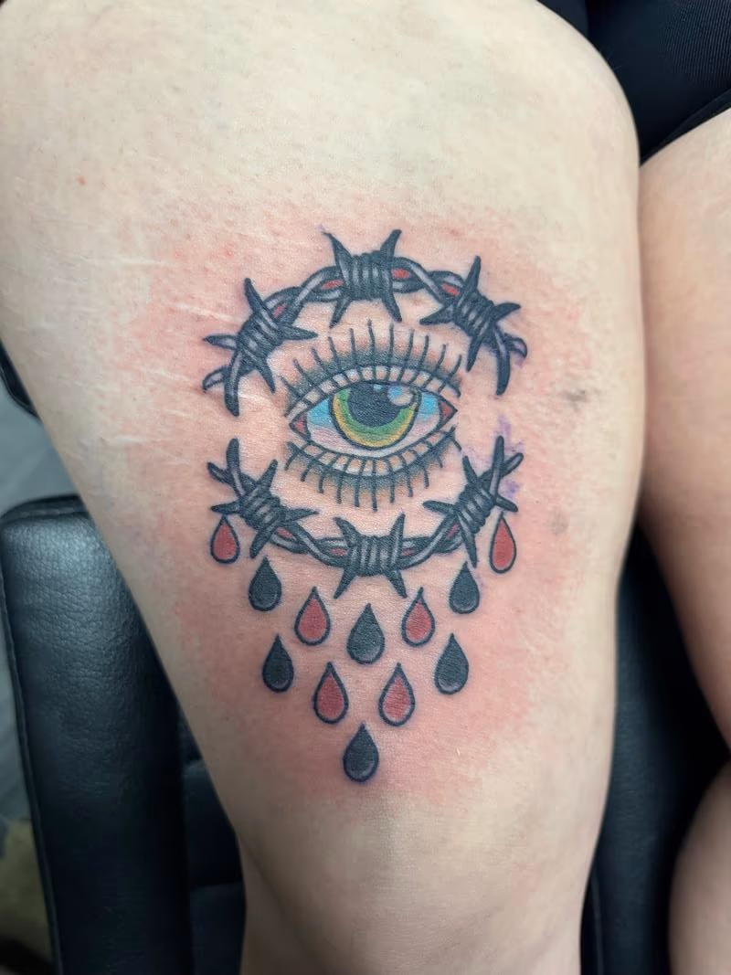 Eye