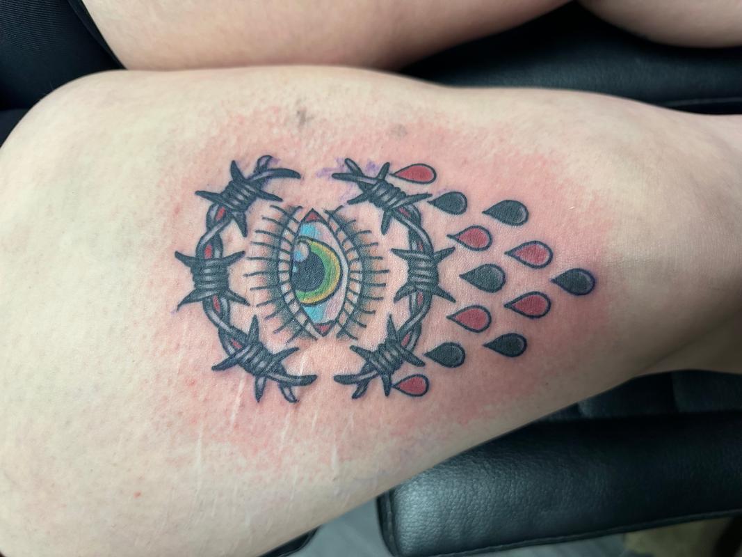 Eye