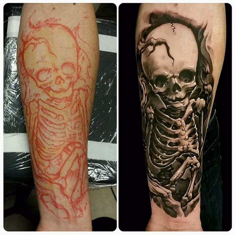 skeleton