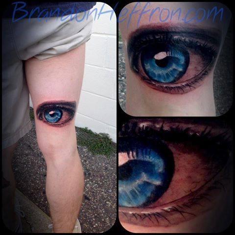 Eyeball