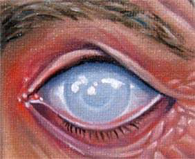 Small Eye Art