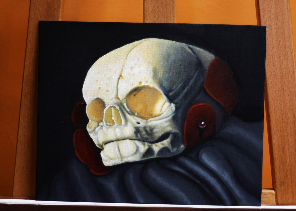 Fetal Skull