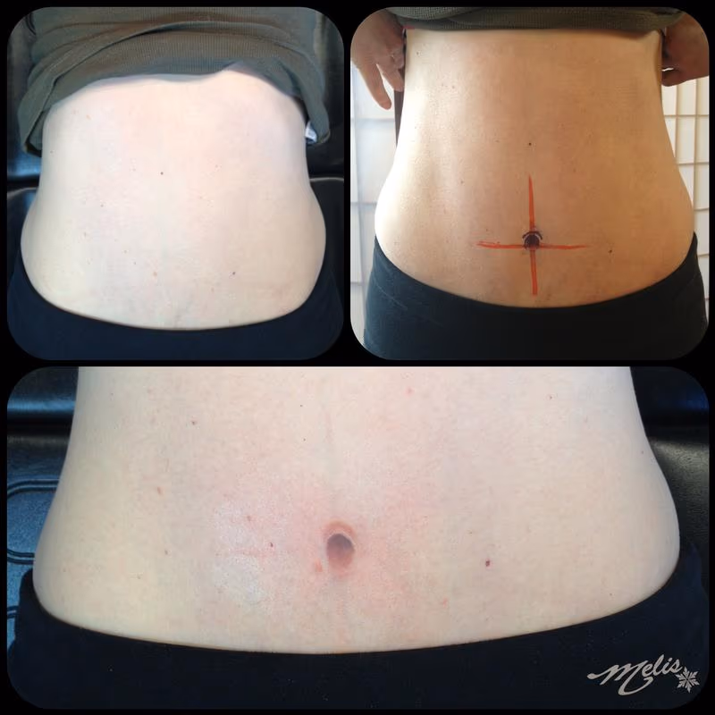 belly button cosmetic