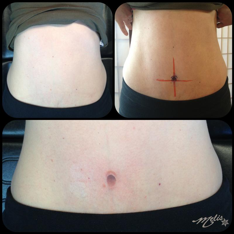 belly button cosmetic