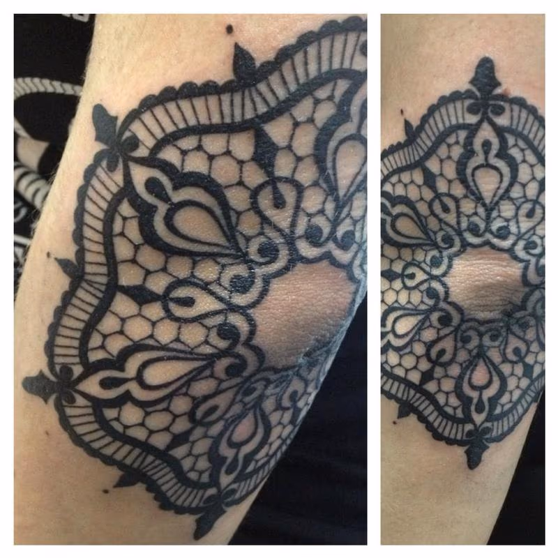 cute lace on elbow