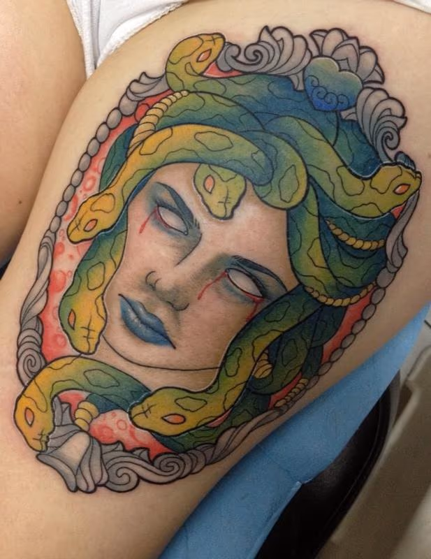Medusa