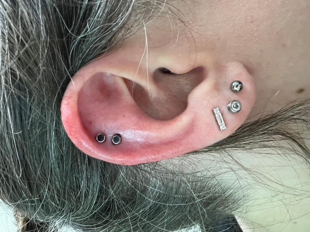 Helix