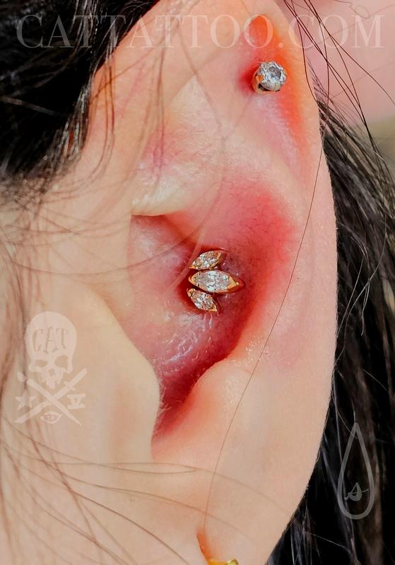 Cartilage Ear Piercing