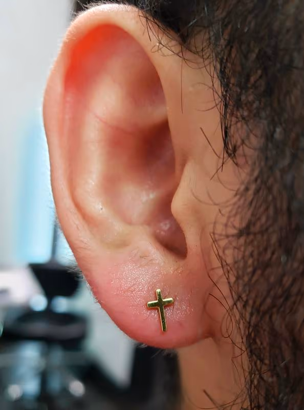 Earlobe