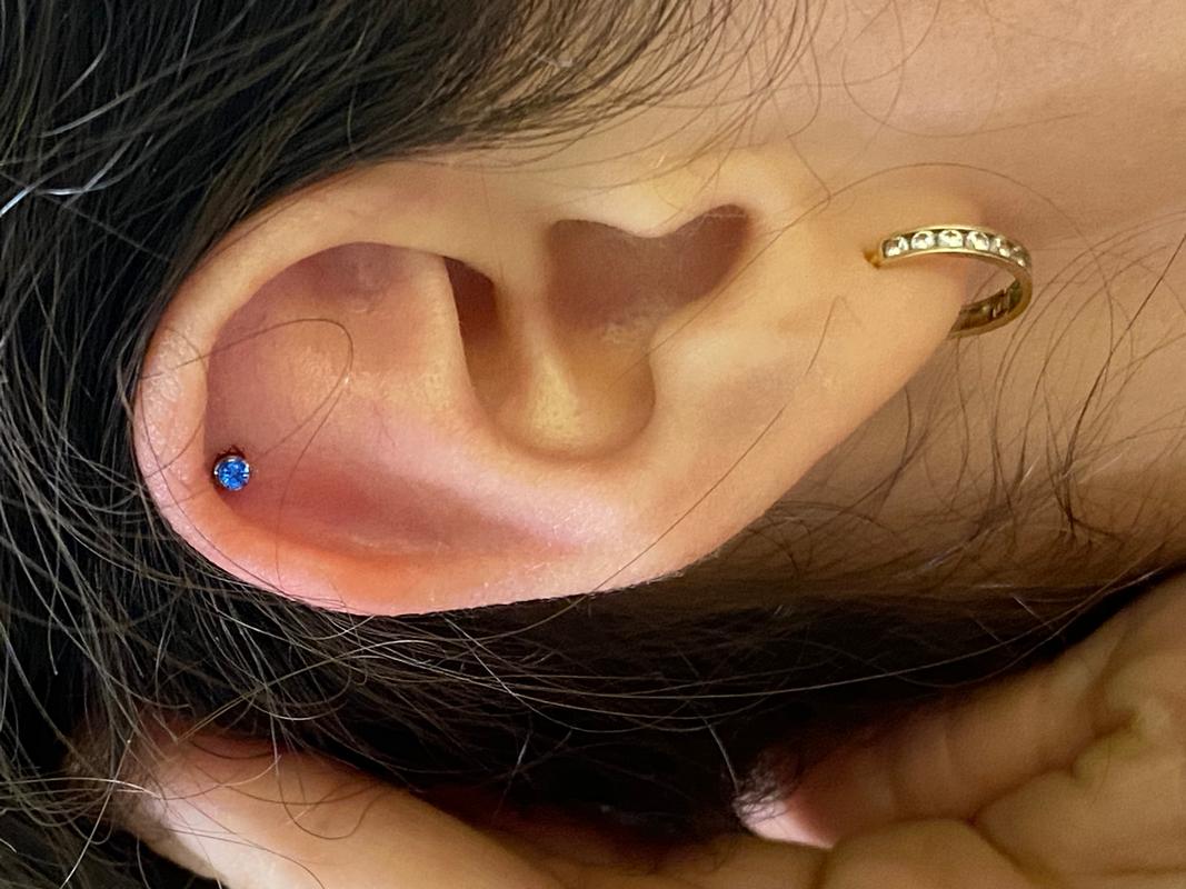 Helix