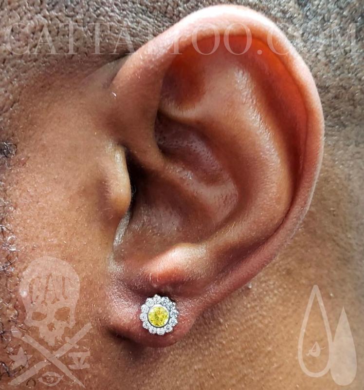 Lobe