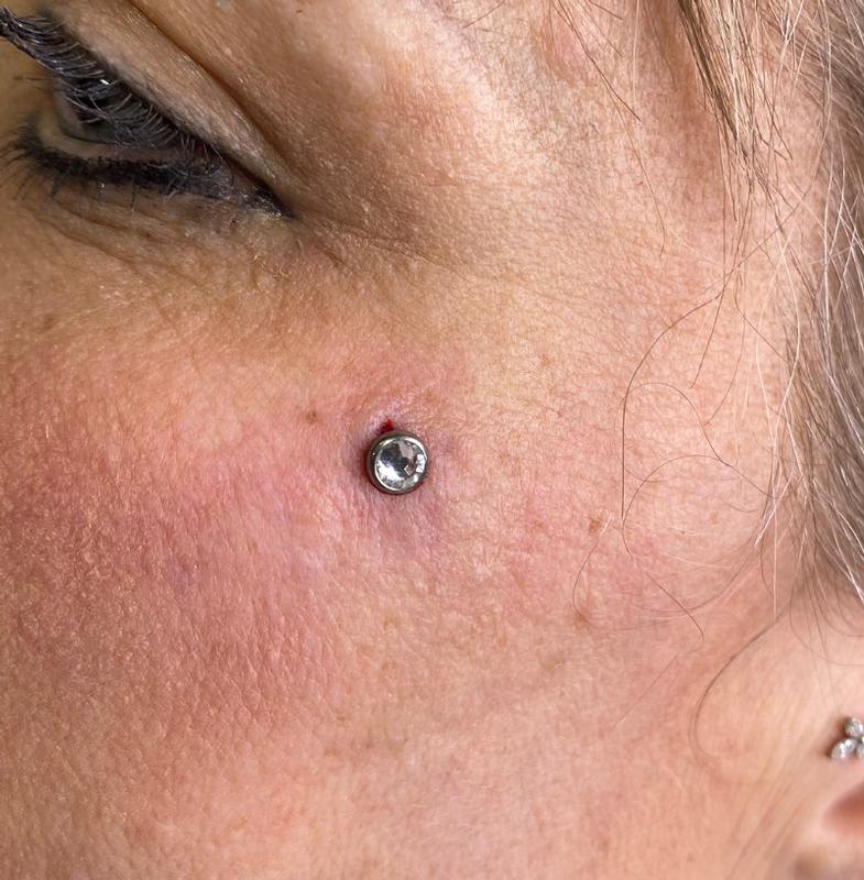 Facial Dermal