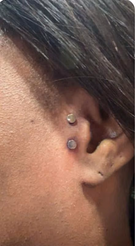 Tragus Surface bar piercing