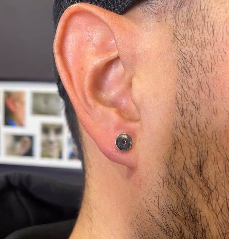 Large Guage Lobes