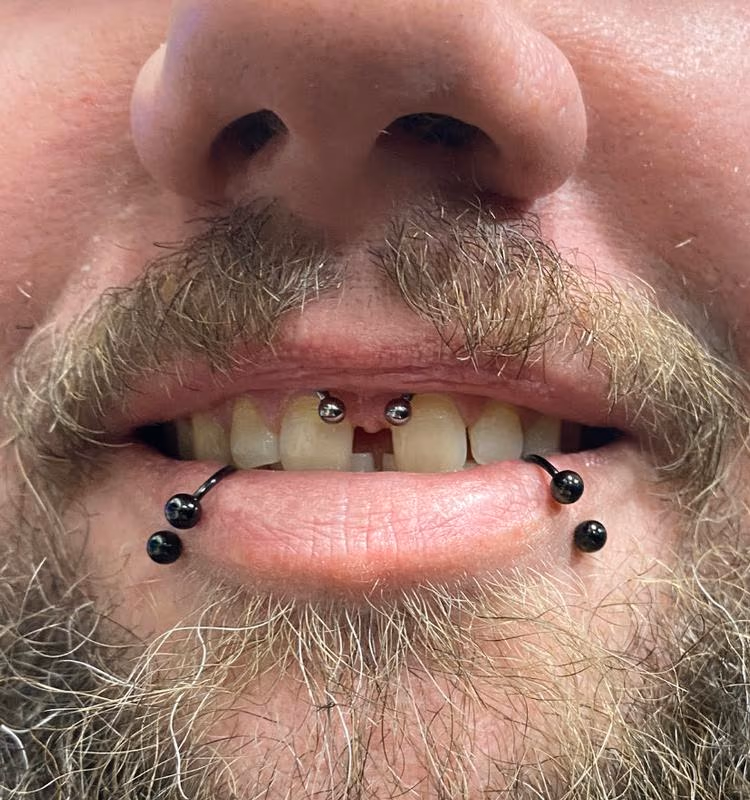 Smiley Piercing