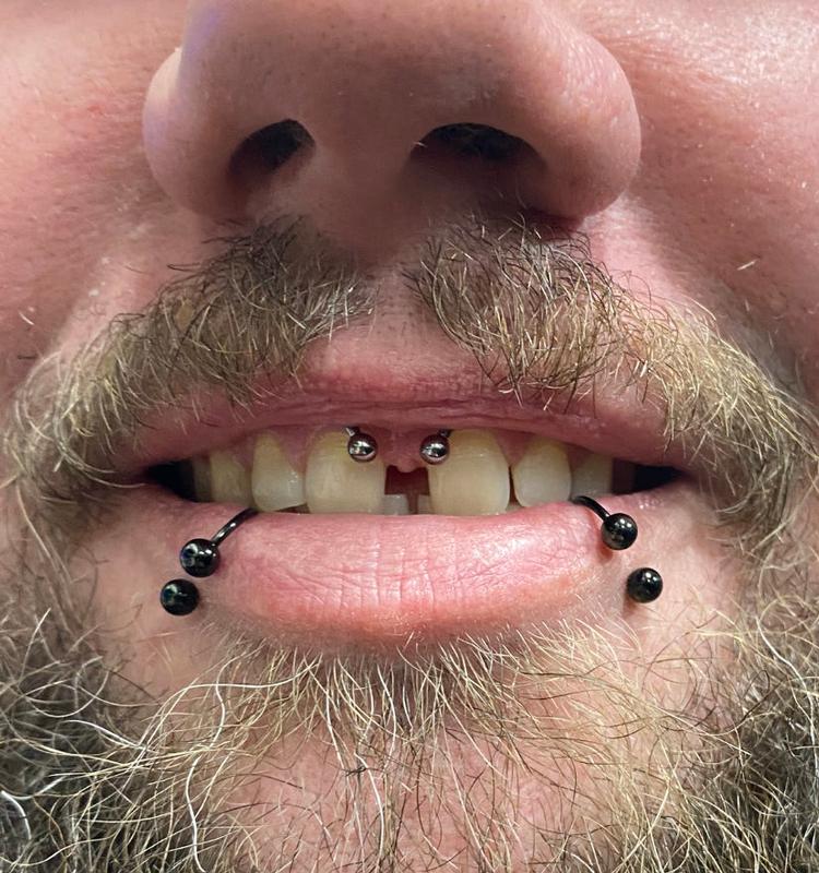 Smiley Piercing