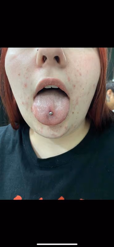 Tongue Piercing